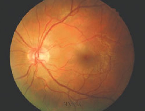 36d28fae07d88713c69ea3d8425c0c74