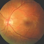 36d28fae07d88713c69ea3d8425c0c74