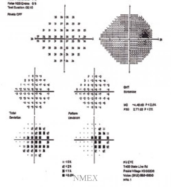 96a7be1992a6812ce9701ca0b679c549