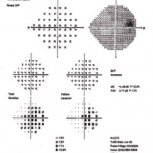 96a7be1992a6812ce9701ca0b679c549